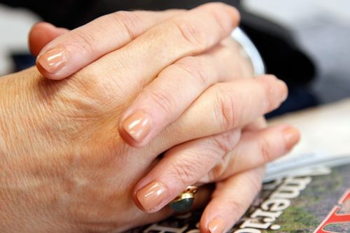 Strzelanie palcami u rąk – to może być jeden z objawów artretyzmu!